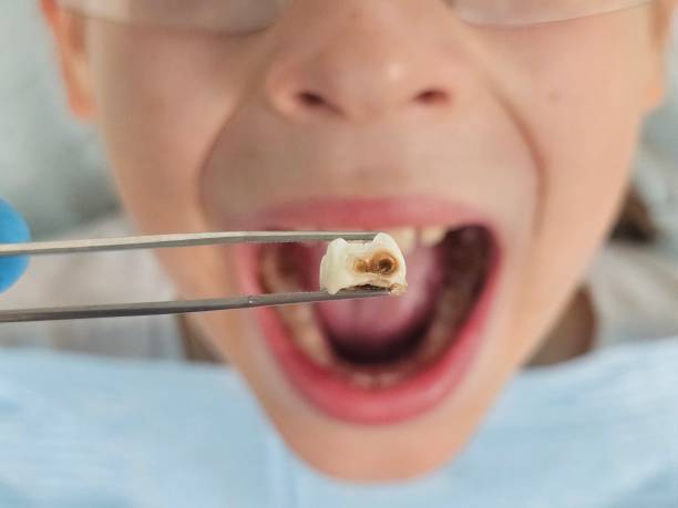 Best Emergency Dentist for Knocked-Out Tooth in Mundelein, IL